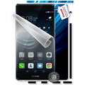 ScreenShield fólie na displej + skin voucher (vč. popl. za dopr.) pro Huawei P9